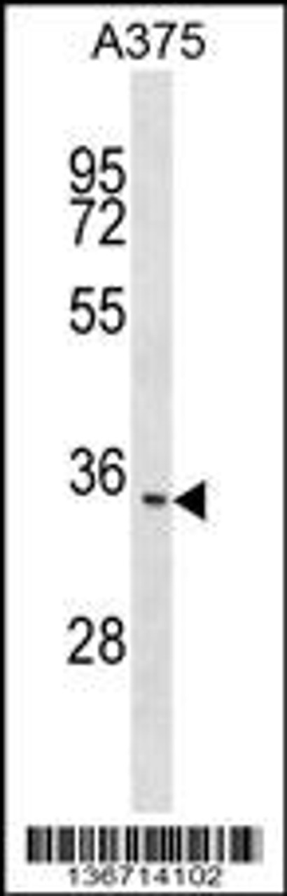 Western blot analysis in A375 cell line lysates (35ug/lane) .