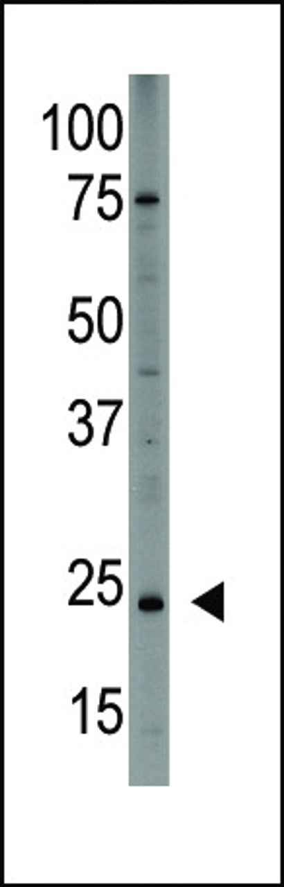 Antibody is used in Western blot to detect PDGFA in HL60 cell lysate.