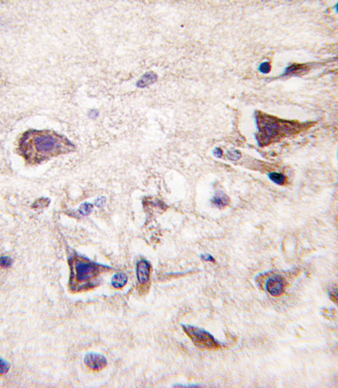 Formalin-fixed and paraffin-embedded human brain tissue reacted with PDGFA antibody (N-term) , which was peroxidase-conjugated to the secondary antibody, followed by DAB staining.