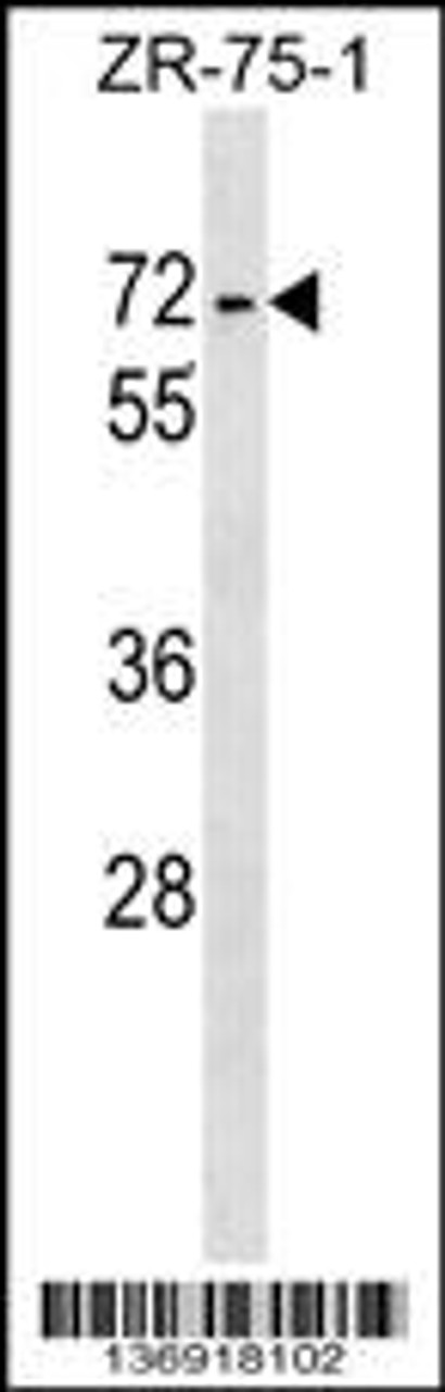 Western blot analysis in ZR-75-1 cell line lysates (35ug/lane) .