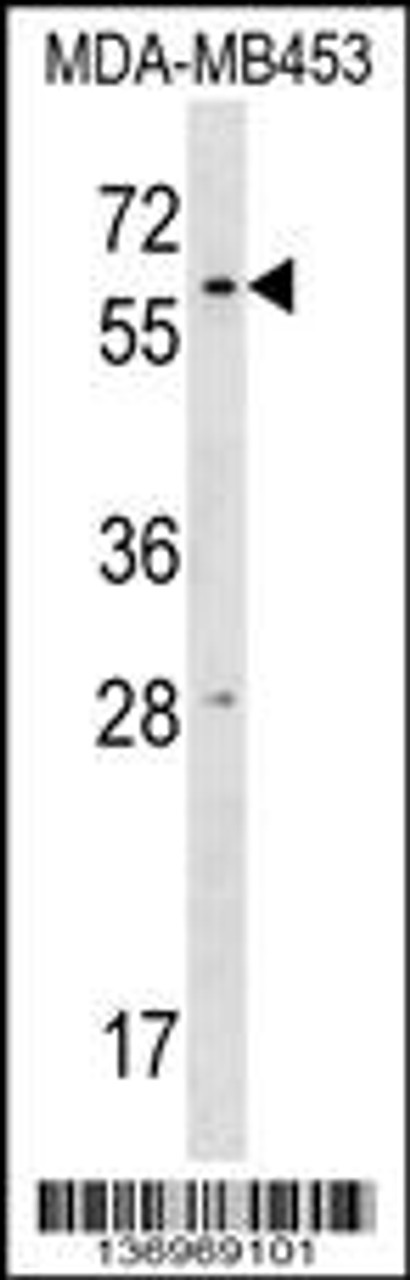 Western blot analysis in MDA-MB453 cell line lysates (35ug/lane) .