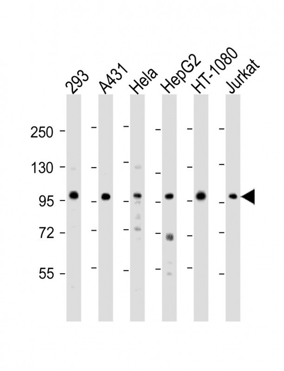 Western Blot at 1:2000 dilution Lane 1: 293 whole cell lysate Lane 2: A431 whole cell lysate Lane 3: Hela whole cell lysate Lane 4: HepG2 whole cell lysate Lane 5: HT-1080 whole cell lysate Lane 6: Jurkat whole cell lysate Lysates/proteins at 20 ug per lane.