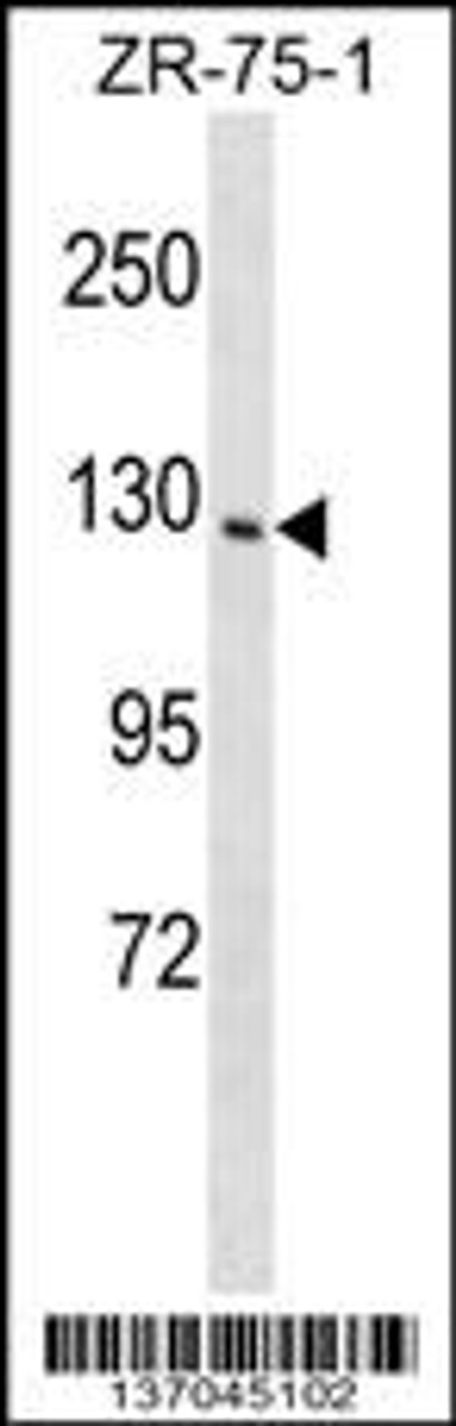 Western blot analysis in ZR-75-1 cell line lysates (35ug/lane) .