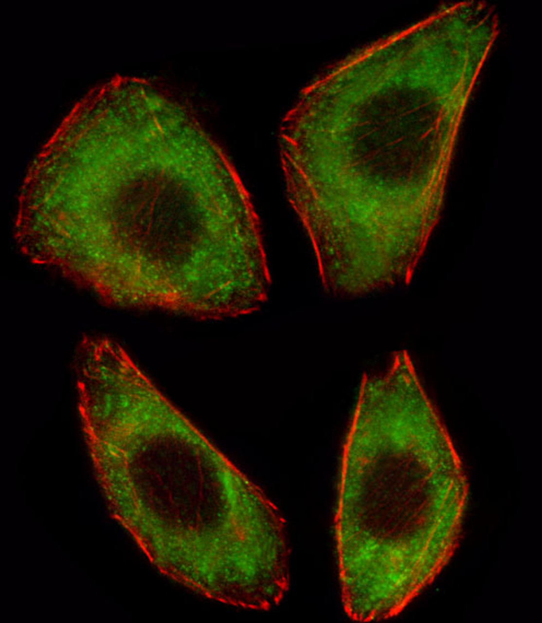 Fluorescent image of A549 cell stained with TCF25 Antibody (N-term) .A549 cells were fixed with 4% PFA (20 min) , permeabilized with Triton X-100 (0.1%, 10 min) , then incubated with TCF25 primary antibody (1:25) . For secondary antibody, Alexa Fluor 488 conjugated donkey anti-rabbit antibody (green) was used (1:400) .Cytoplasmic actin was counterstained with Alexa Fluor 555 (red) conjugated Phalloidin (7units/ml) .TCF25 immunoreactivity is localized to Cytoplasm significantly.