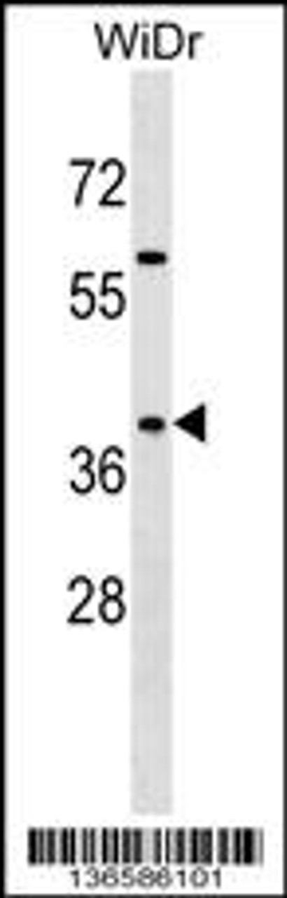 Western blot analysis in WiDr cell line lysates (35ug/lane) .