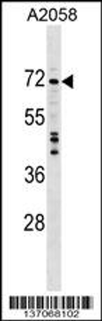 Western blot analysis in A2058 cell line lysates (35ug/lane) .