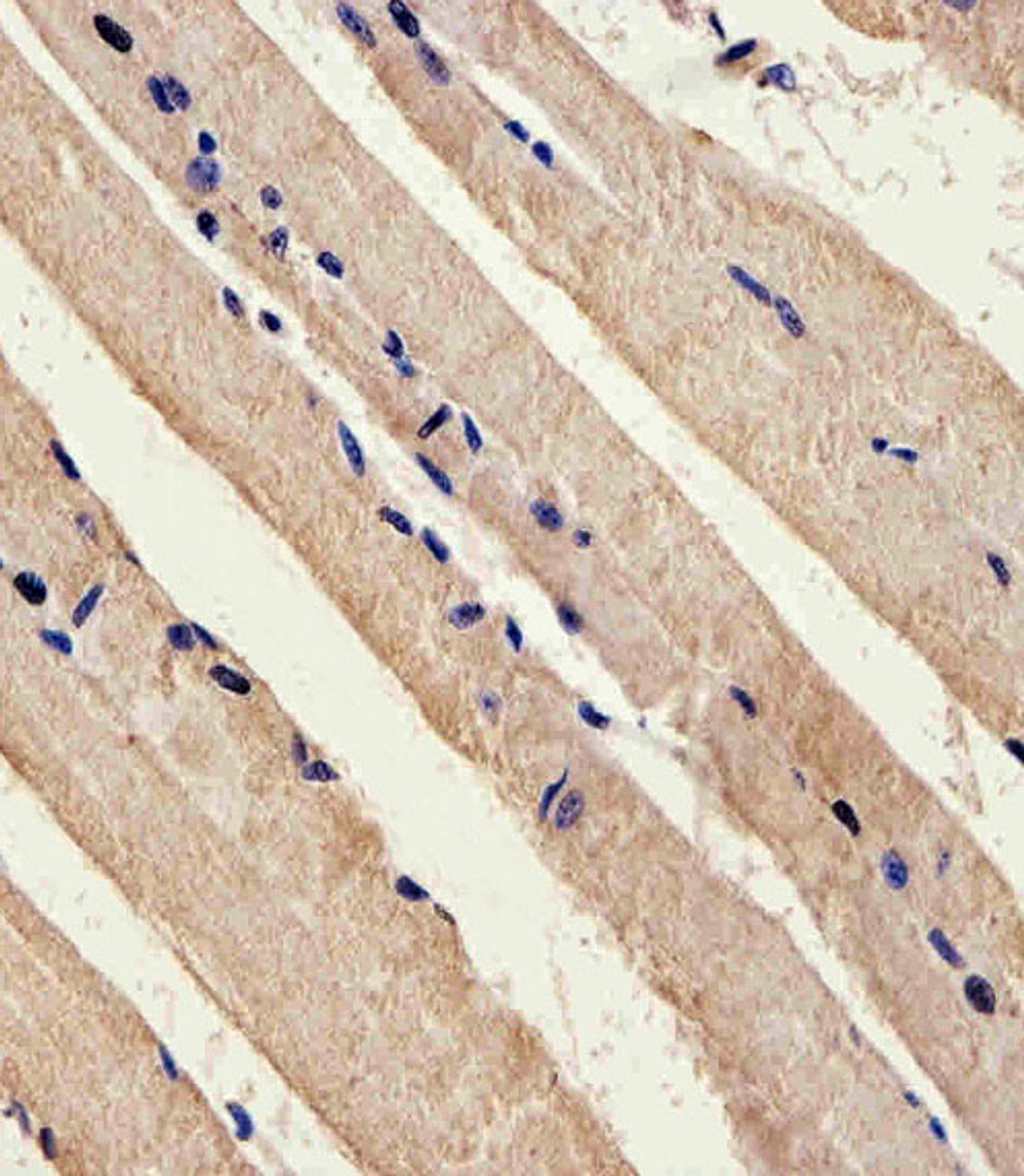 Immunohistochemical analysis of paraffin-embedded M.skeletal muscle section using Mouse Stk11 Antibody . Antibody was diluted at 1:25 dilution. A peroxidase-conjugated goat anti-rabbit IgG at 1:400 dilution was used as the secondary antibody, followed by DAB staining.