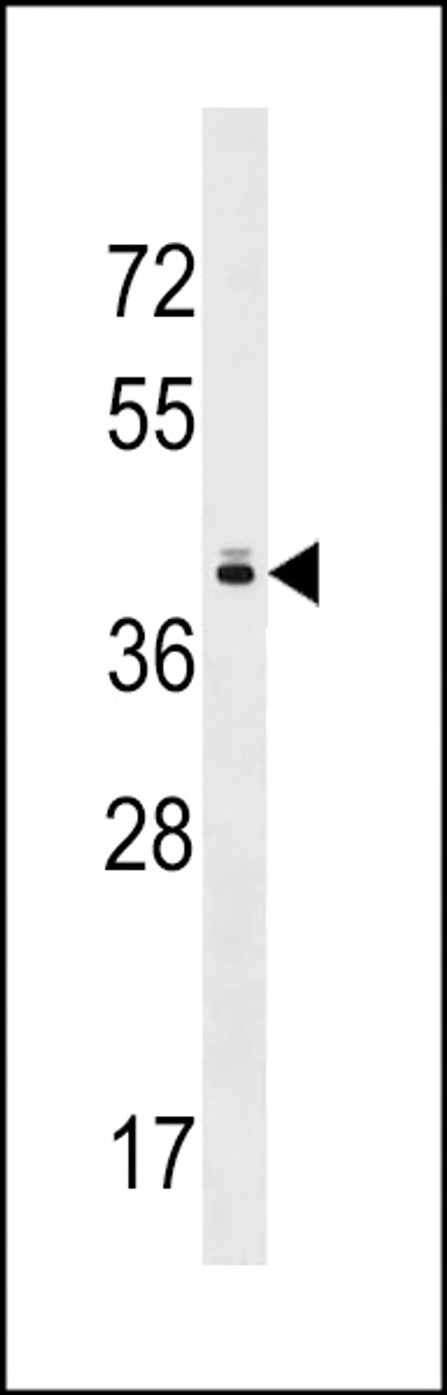 Western blot analysis in MDA-MB453 cell line lysates (35ug/lane) .