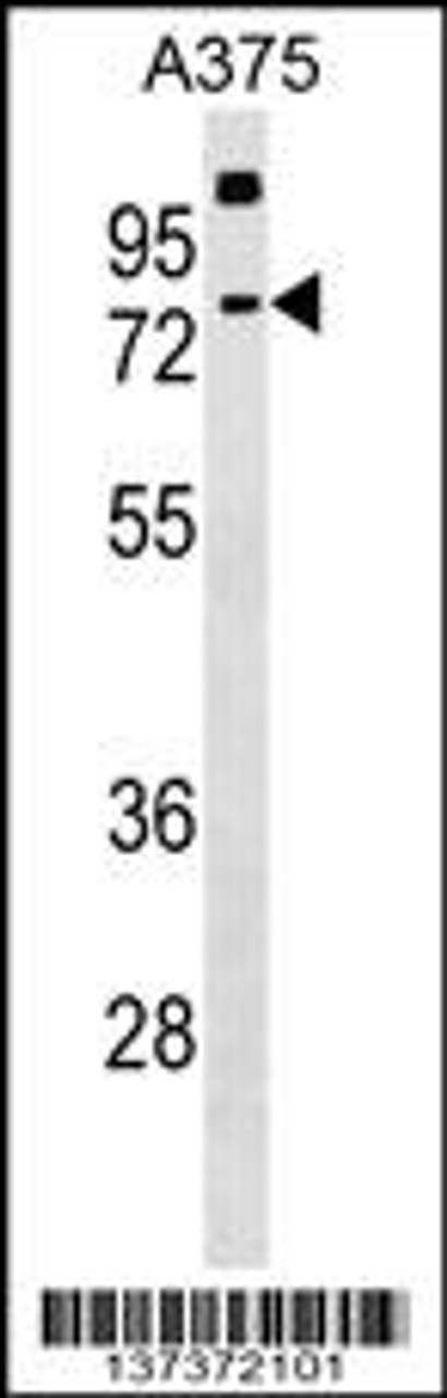 Western blot analysis in A375 cell line lysates (35ug/lane) .