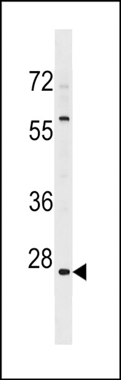 Western blot analysis in 293 cell line lysates (35ug/lane) .