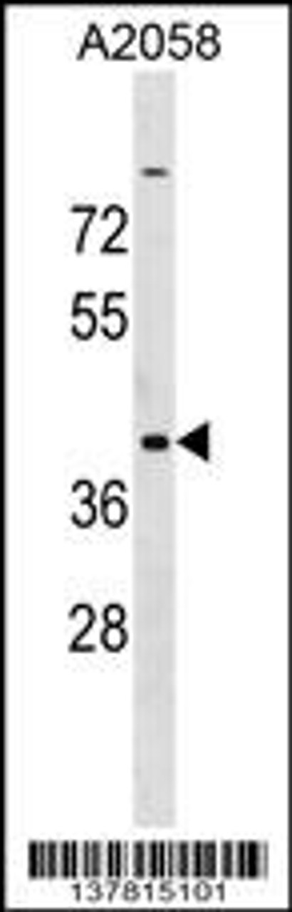 Western blot analysis in A2058 cell line lysates (35ug/lane) .