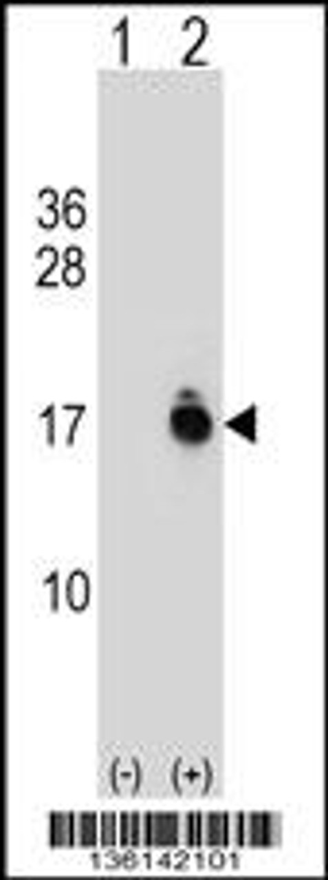 Western blot analysis of ACYP1 using rabbit polyclonal ACYP1 Antibody using 293 cell lysates (2 ug/lane) either nontransfected (Lane 1) or transiently transfected (Lane 2) with the ACYP1 gene.