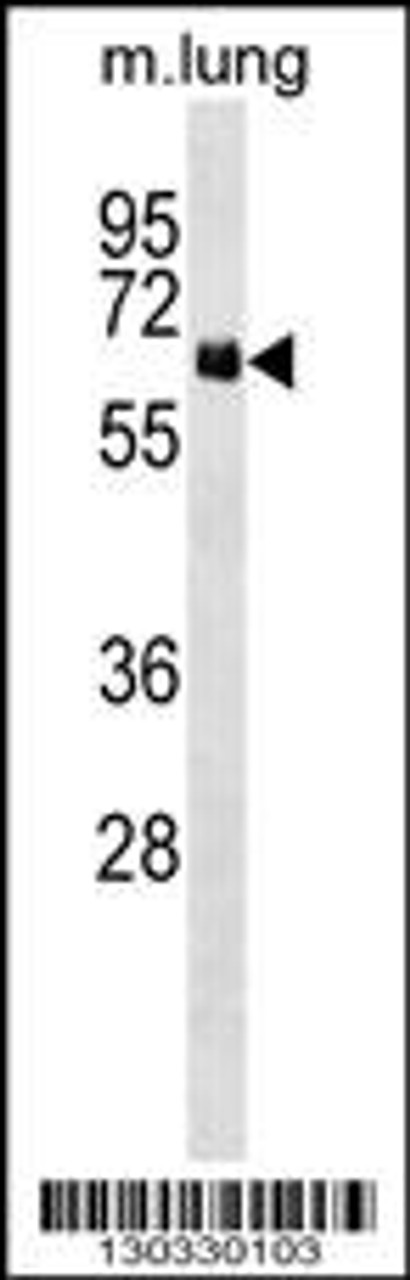 Western blot analysis in mouse lung tissue lysates (35ug/lane) .