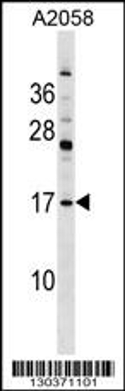 Western blot analysis in A2058 cell line lysates (35ug/lane) .