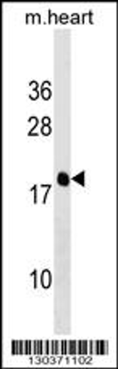 Western blot analysis in mouse heart tissue lysates (35ug/lane) .