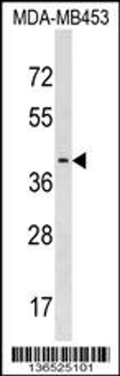 Western blot analysis in MDA-MB453 cell line lysates (35ug/lane) .