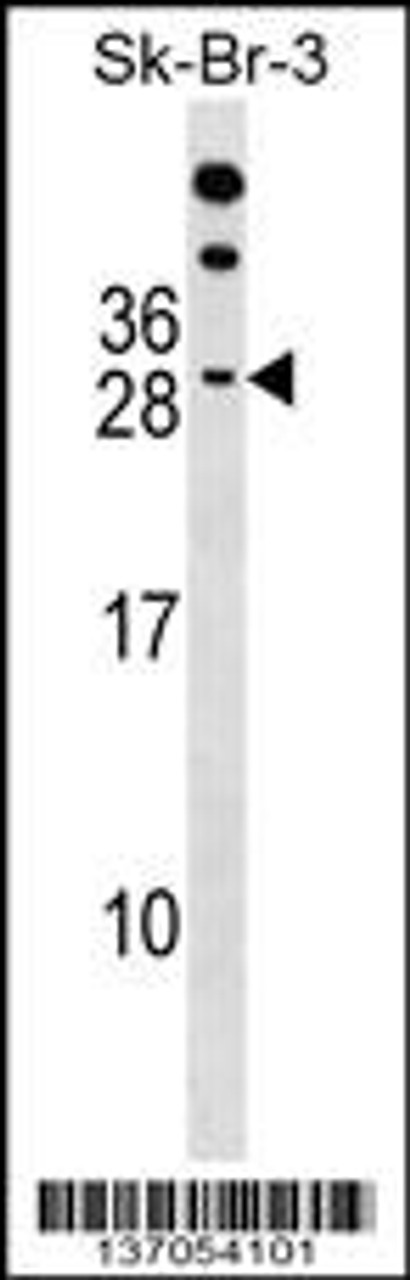 Western blot analysis in SK-BR-3 cell line lysates (35ug/lane) .