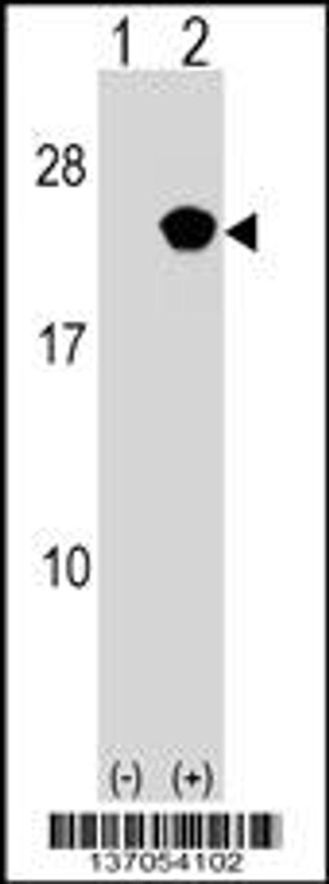 Western blot analysis of RAP2B using rabbit polyclonal RAP2B Antibody using 293 cell lysates (2 ug/lane) either nontransfected (Lane 1) or transiently transfected (Lane 2) with the RAP2B gene.