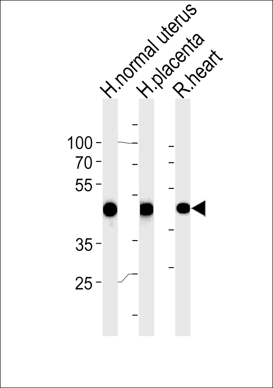 Western blot analysis in human normal uterus and placenta, rat heart tissue lysates (35ug/lane) .This demonstrates the ACTA1/alpha -actin antibody detected the ACTA1/alpha -actin protein (arrow) .