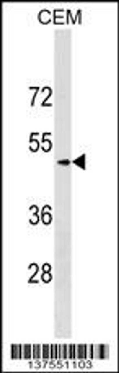 Western blot analysis in CEM cell line lysates (35ug/lane) .