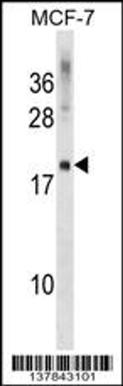 Western blot analysis in MCF-7 cell line lysates (35ug/lane) .