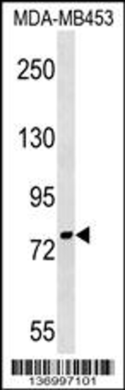 Western blot analysis in MDA-MB453 cell line lysates (35ug/lane) .