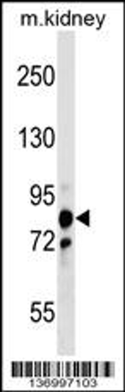 Western blot analysis in mouse kidney tissue lysates (35ug/lane) .