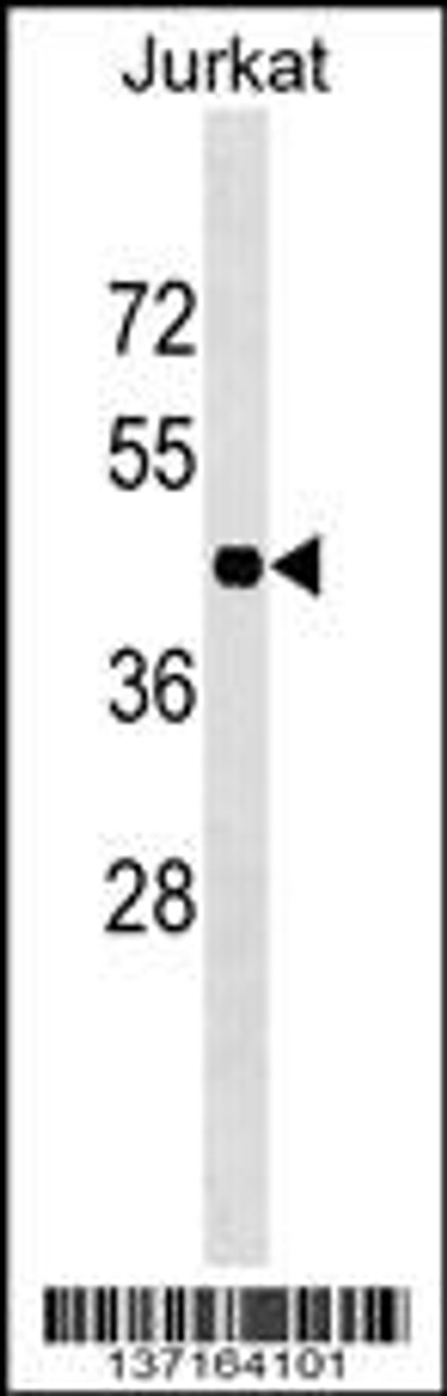 Western blot analysis in Jurkat cell line lysates (35ug/lane) .