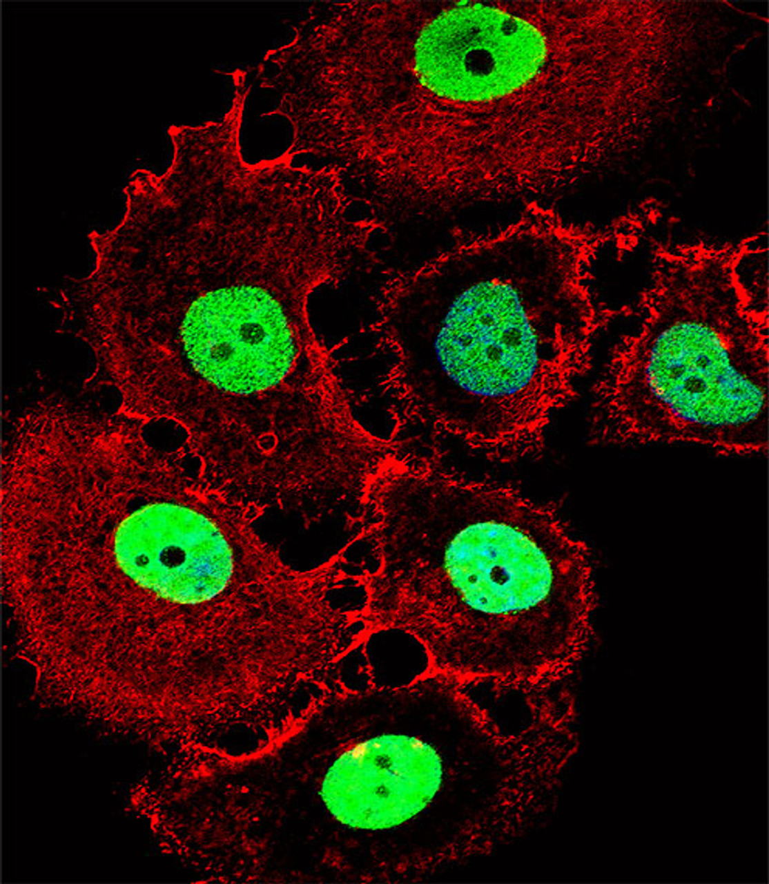 Fluorescent confocal image of MCF-7 cell stained with HOXC10 Antibody .MCF-7 cells were fixed with 4% PFA (20 min) , permeabilized with Triton X-100 (0.1%, 10 min) , then incubated with HOXC10 primary antibody (1:25) . For secondary antibody, Alexa Fluor 488 conjugated donkey anti-rabbit antibody (green) was used (1:400) .Cytoplasmic actin was counterstained with Alexa Fluor 555 (red) conjugated Phalloidin (7units/ml) . Nuclei were counterstained with DAPI (blue) (10 ug/ml, 10 min) . HOXC10 immunoreactivity is localized to Nucleus significantly.