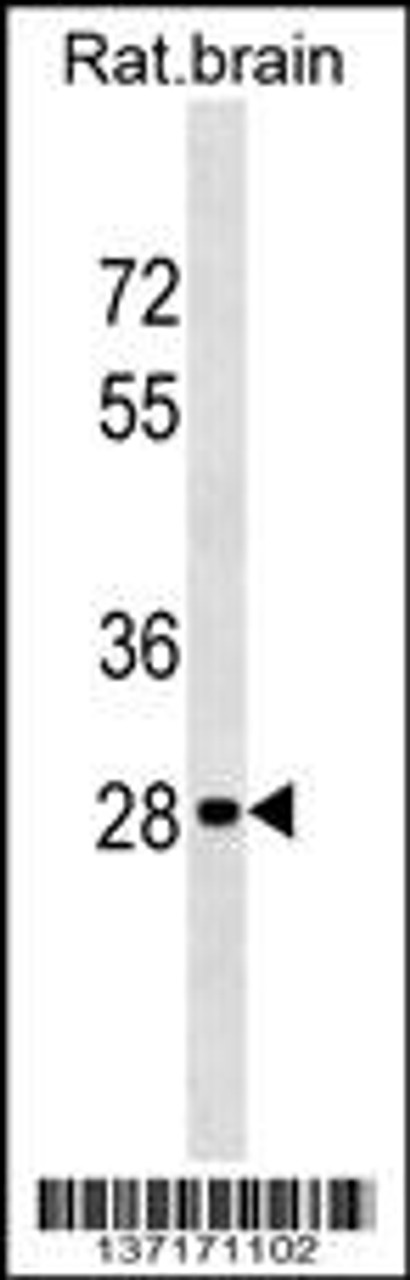 Western blot analysis in rat brain tissue lysates (35ug/lane) .This demonstrates detected the Hoxd9 protein (arrow) .