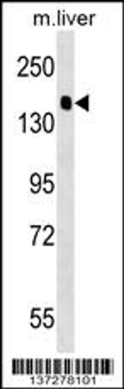 Western blot analysis in mouse liver tissue lysates (35ug/lane) .