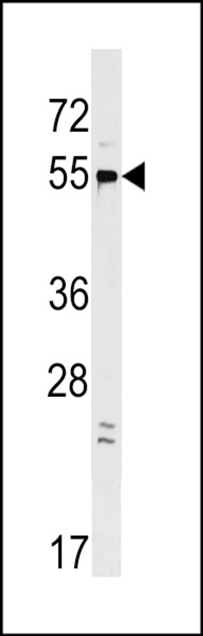 Western blot analysis in HepG2 cell line lysates (35ug/lane) .