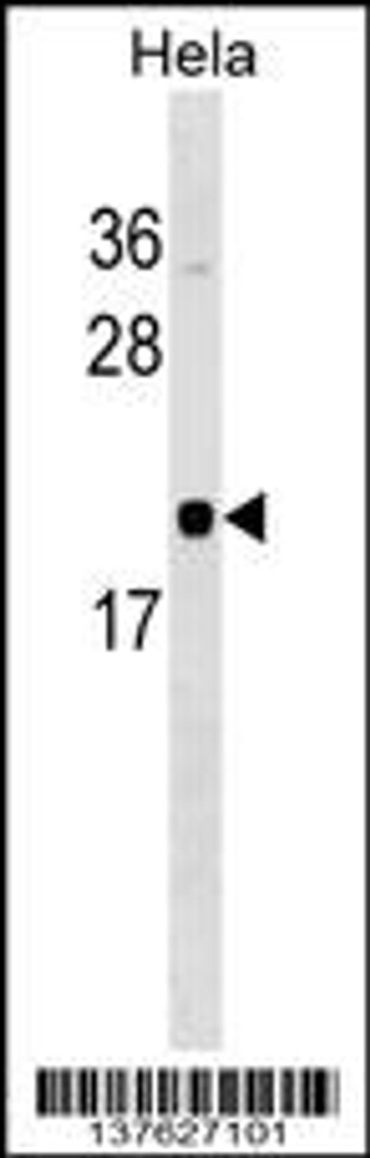 Western blot analysis in Hela cell line lysates (35ug/lane) .