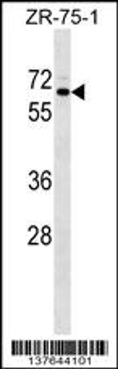 Western blot analysis in ZR-75-1 cell line lysates (35ug/lane) .