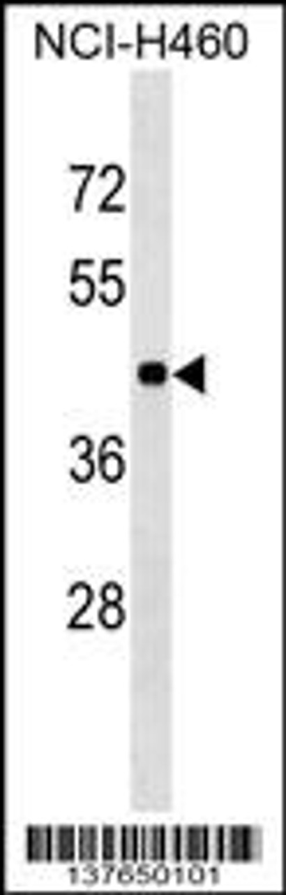 Western blot analysis in NCI-H460 cell line lysates (35ug/lane) .