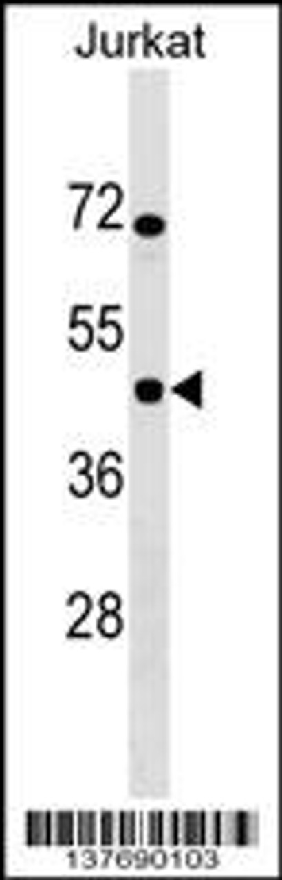 Western blot analysis in Jurkat cell line lysates (35ug/lane) .