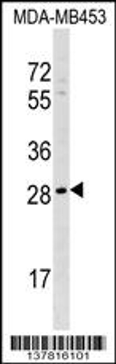 Western blot analysis in MDA-MB453 cell line lysates (35ug/lane) .