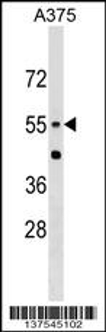 Western blot analysis in A375 cell line lysates (35ug/lane) .