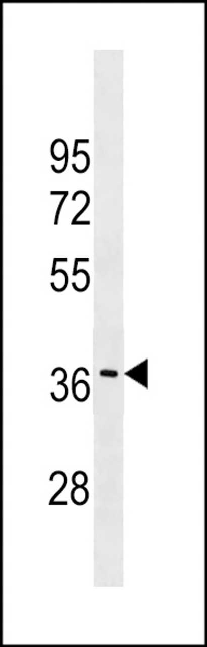 Western blot analysis in MDA-MB453 cell line lysates (35ug/lane) .