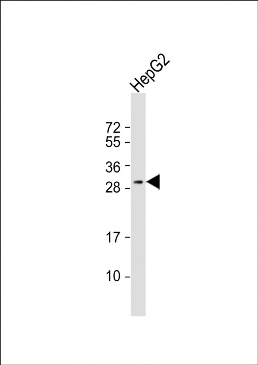 Western Blot at 1:1000 dilution + HepG2 whole cell lysate Lysates/proteins at 20 ug per lane.