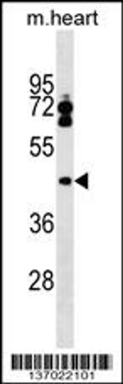 Western blot analysis in mouse heart tissue lysates (35ug/lane) .