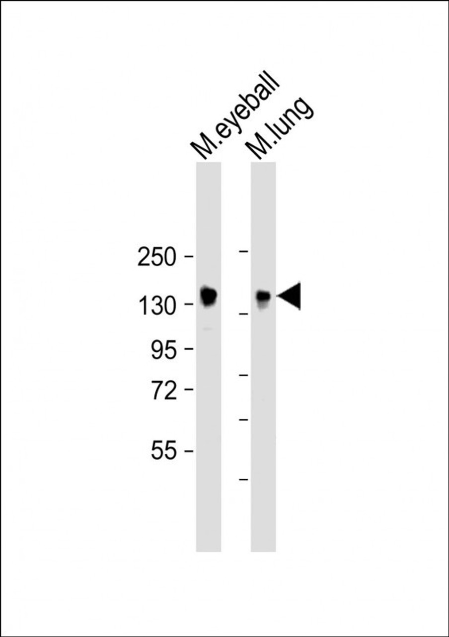 Western Blot at 1:2000 dilution Lane 1: mouse eyeball lysate Lane 2: mouse lung lysate Lysates/proteins at 20 ug per lane.