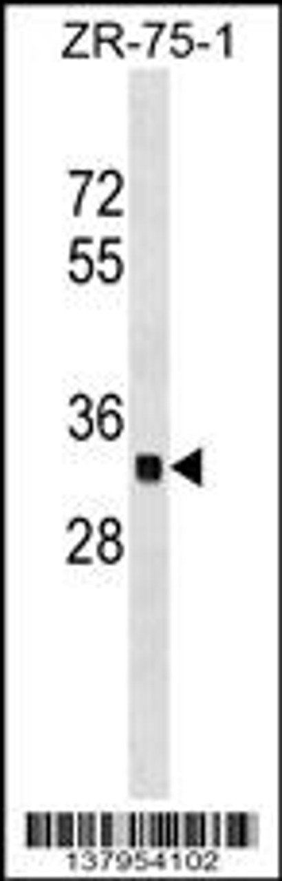 Western blot analysis in ZR-75-1 cell line lysates (35ug/lane) .