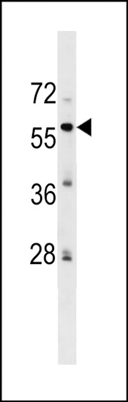 Western blot analysis in HepG2 cell line lysates (35ug/lane) .