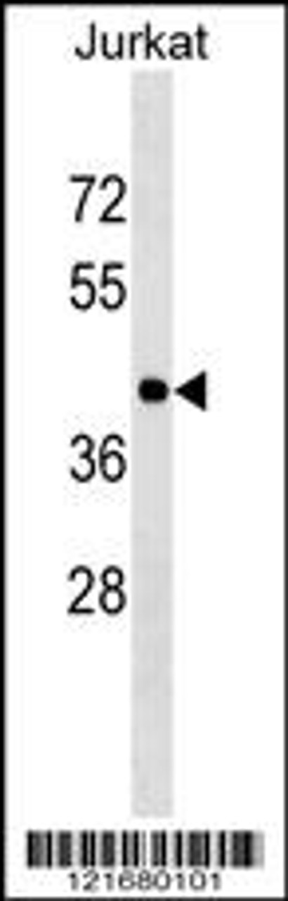 Western blot analysis in Jurkat cell line lysates (35ug/lane) .