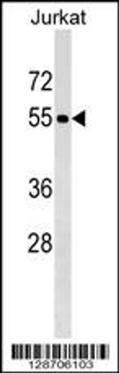 Western blot analysis in Jurkat cell line lysates (35ug/lane) .