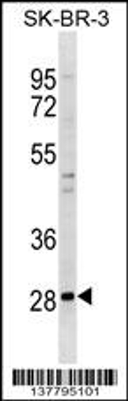 Western blot analysis in SK-BR-3 cell line lysates (35ug/lane) .