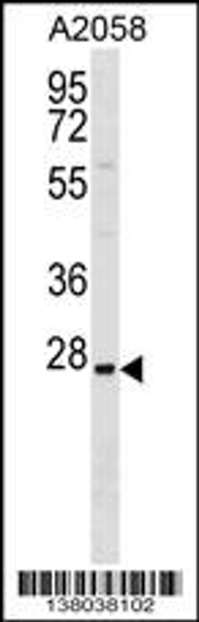 Western blot analysis in A2058 cell line lysates (35ug/lane) .This demonstratdetected the protein (arrow) .