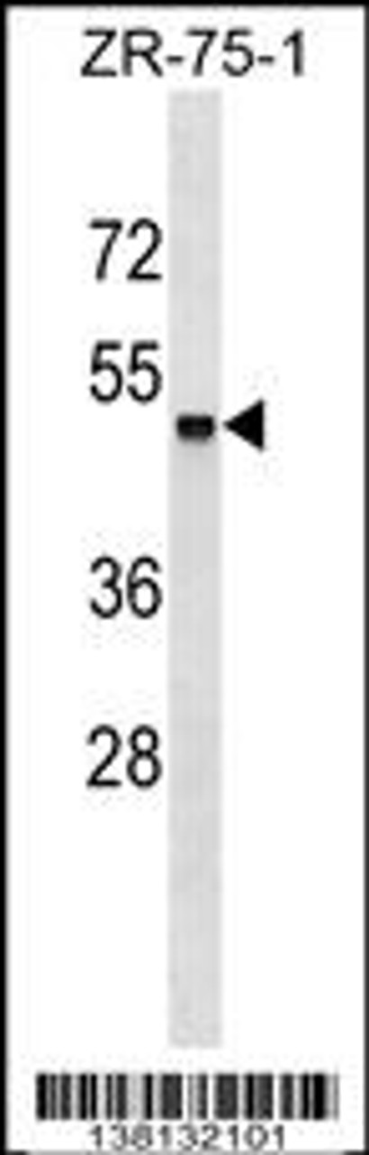 Western blot analysis in ZR-75-1 cell line lysates (35ug/lane) .