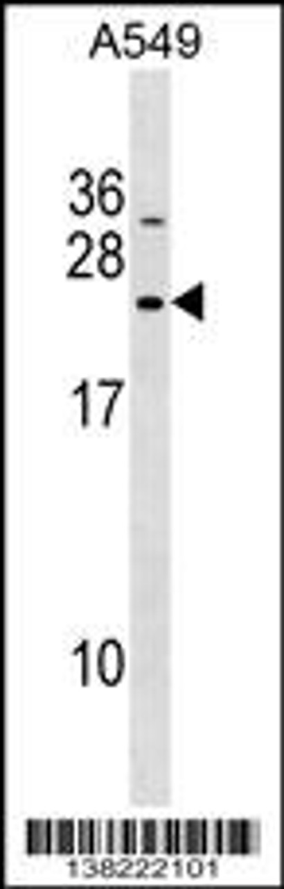 Western blot analysis in A549 cell line lysates (35ug/lane) .